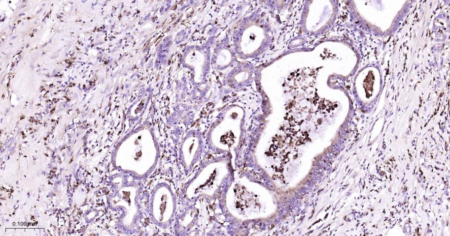溶菌酶重组兔单抗