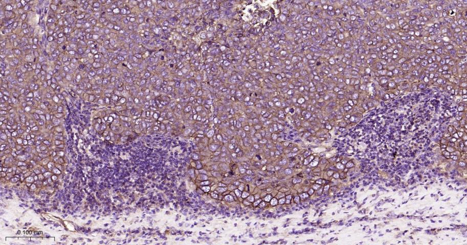 整合素β1（CD29）重组兔单抗