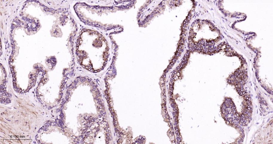RAS癌基因相关蛋白RAB7重组兔单抗