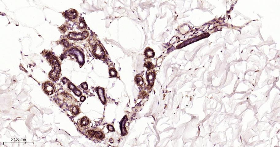 整合素β1（CD29）重组兔单抗