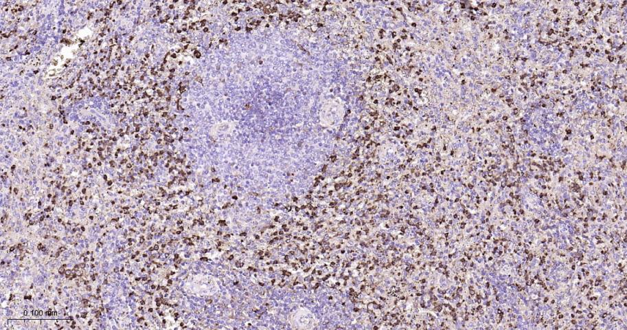 溶菌酶重组兔单抗