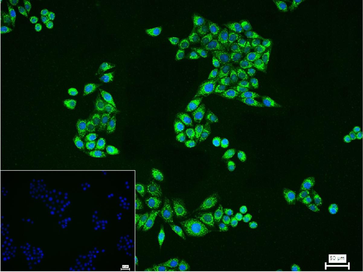 线粒体异柠檬酸脱氢酶重组兔单抗