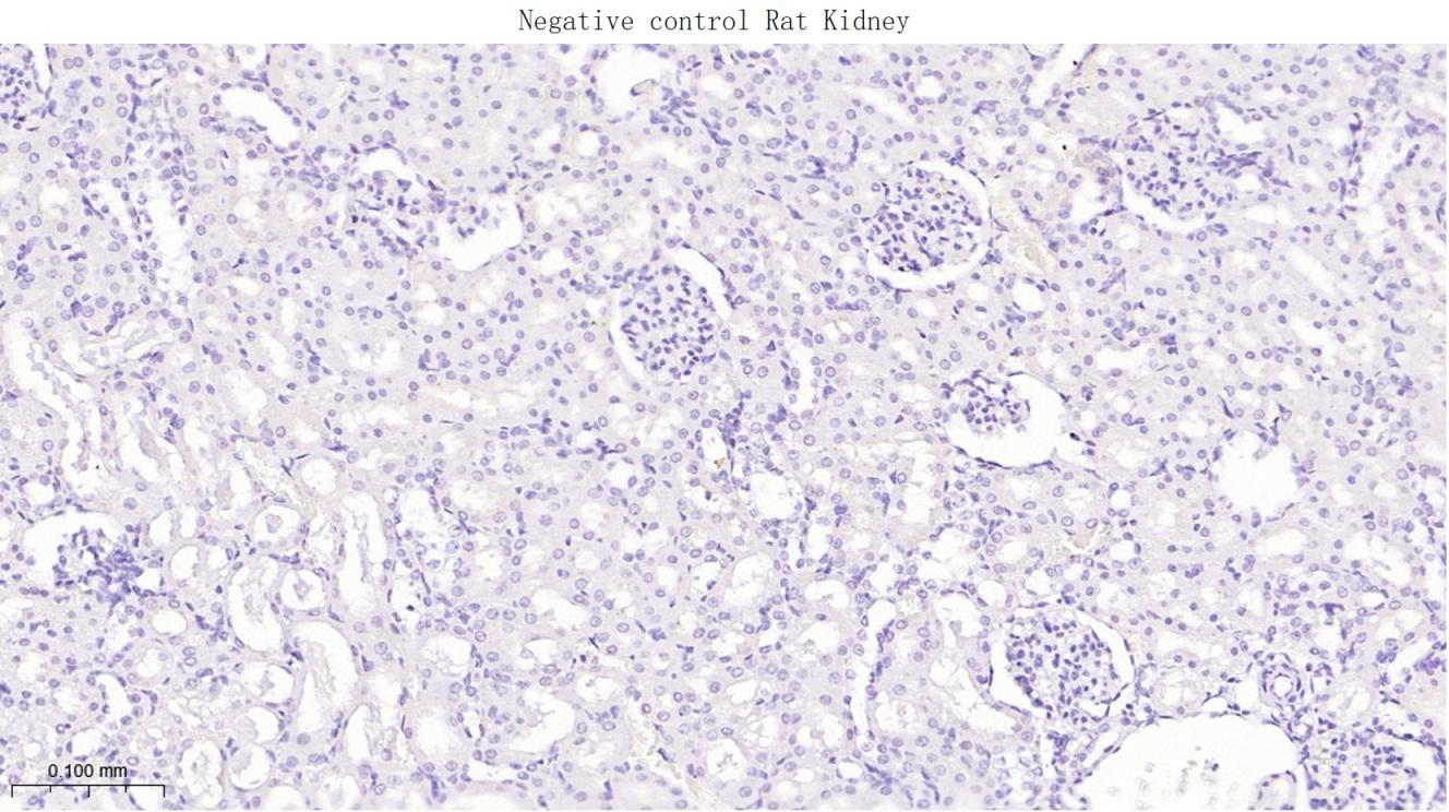 肝肠钙粘连蛋白重组兔单抗
