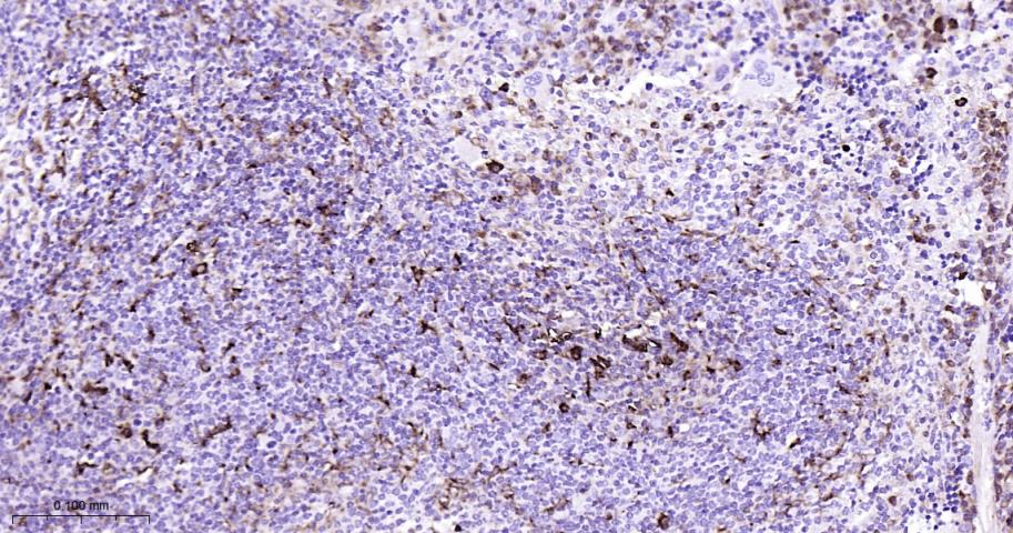 溶菌酶重组兔单抗