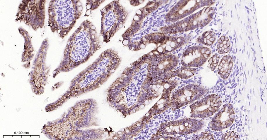 肝肠钙粘连蛋白重组兔单抗