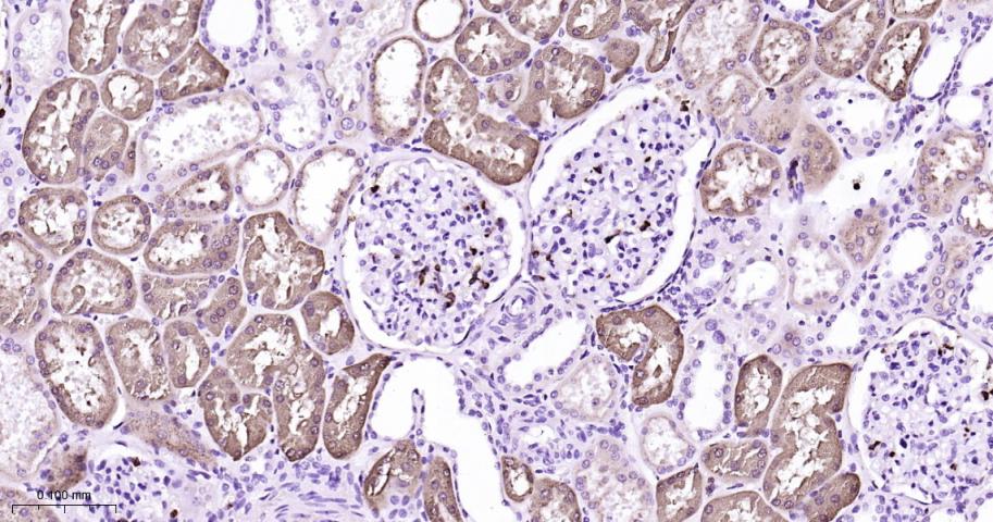 溶菌酶重组兔单抗