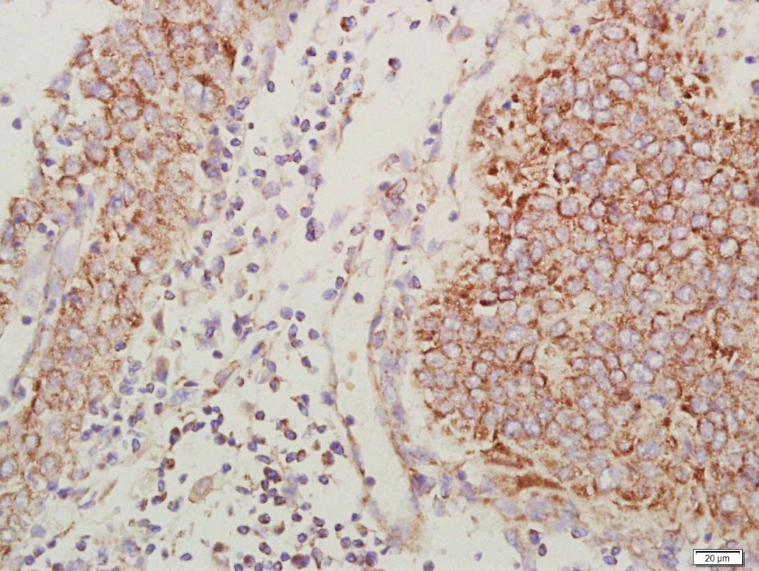 细胞表面趋化因子受体4抗体-bs-1011R