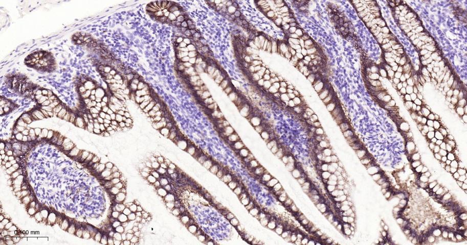 肝肠钙粘连蛋白重组兔单抗
