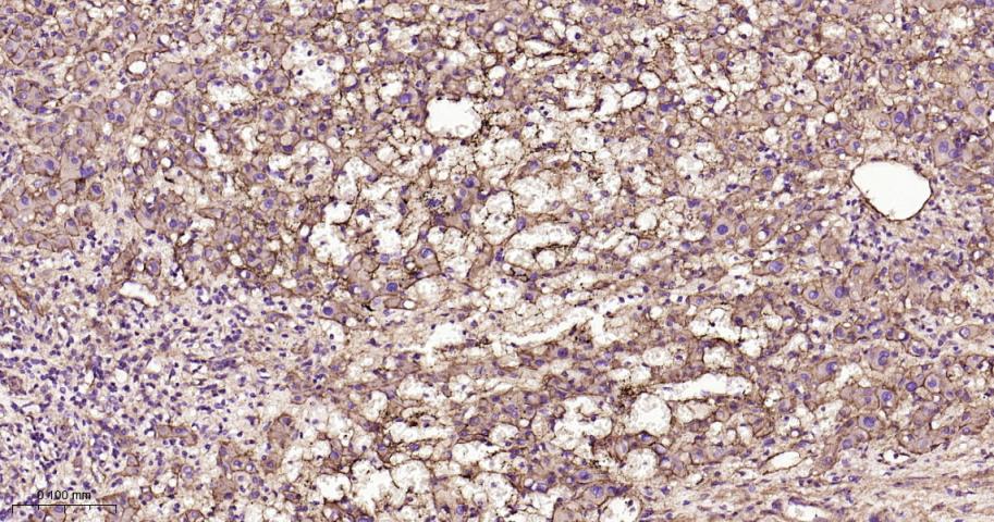 整合素β1（CD29）重组兔单抗