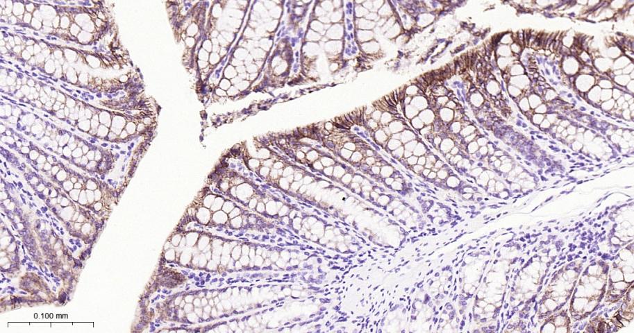 肝肠钙粘连蛋白重组兔单抗