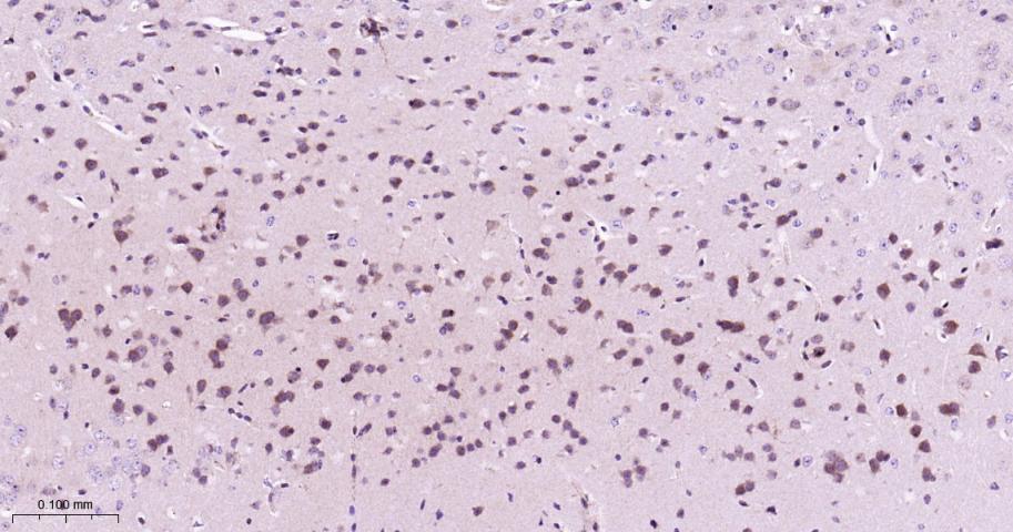 RAS癌基因相关蛋白RAB7重组兔单抗