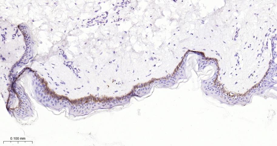 整合素β1（CD29）重组兔单抗