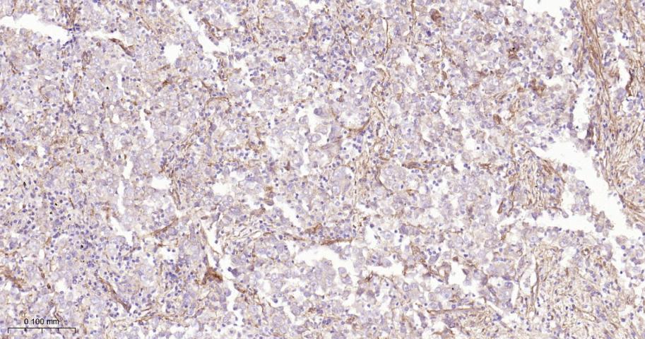 整合素β1（CD29）重组兔单抗