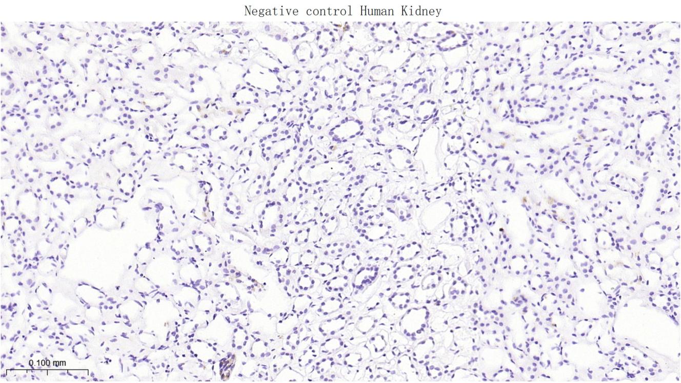 肝肠钙粘连蛋白重组兔单抗