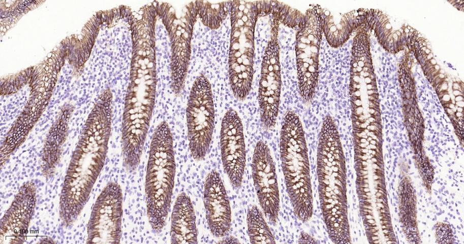 肝肠钙粘连蛋白重组兔单抗