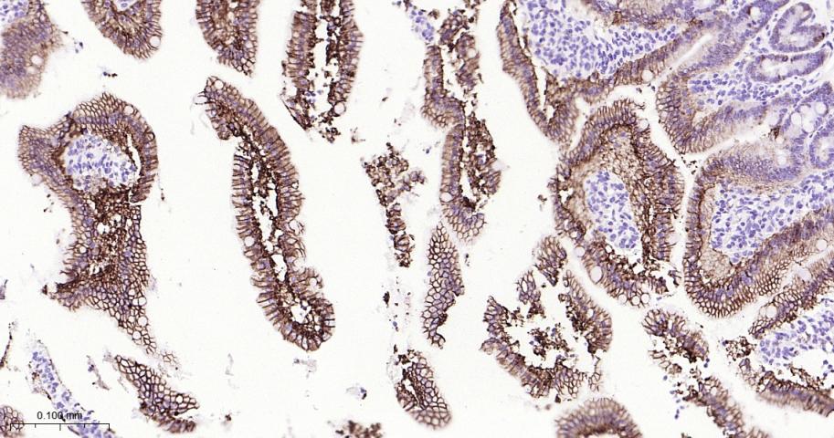 肝肠钙粘连蛋白重组兔单抗