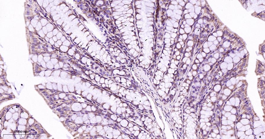 RAS癌基因相关蛋白RAB7重组兔单抗