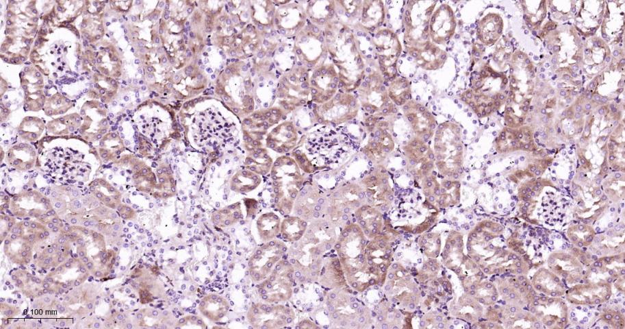 RAS癌基因相关蛋白RAB7重组兔单抗