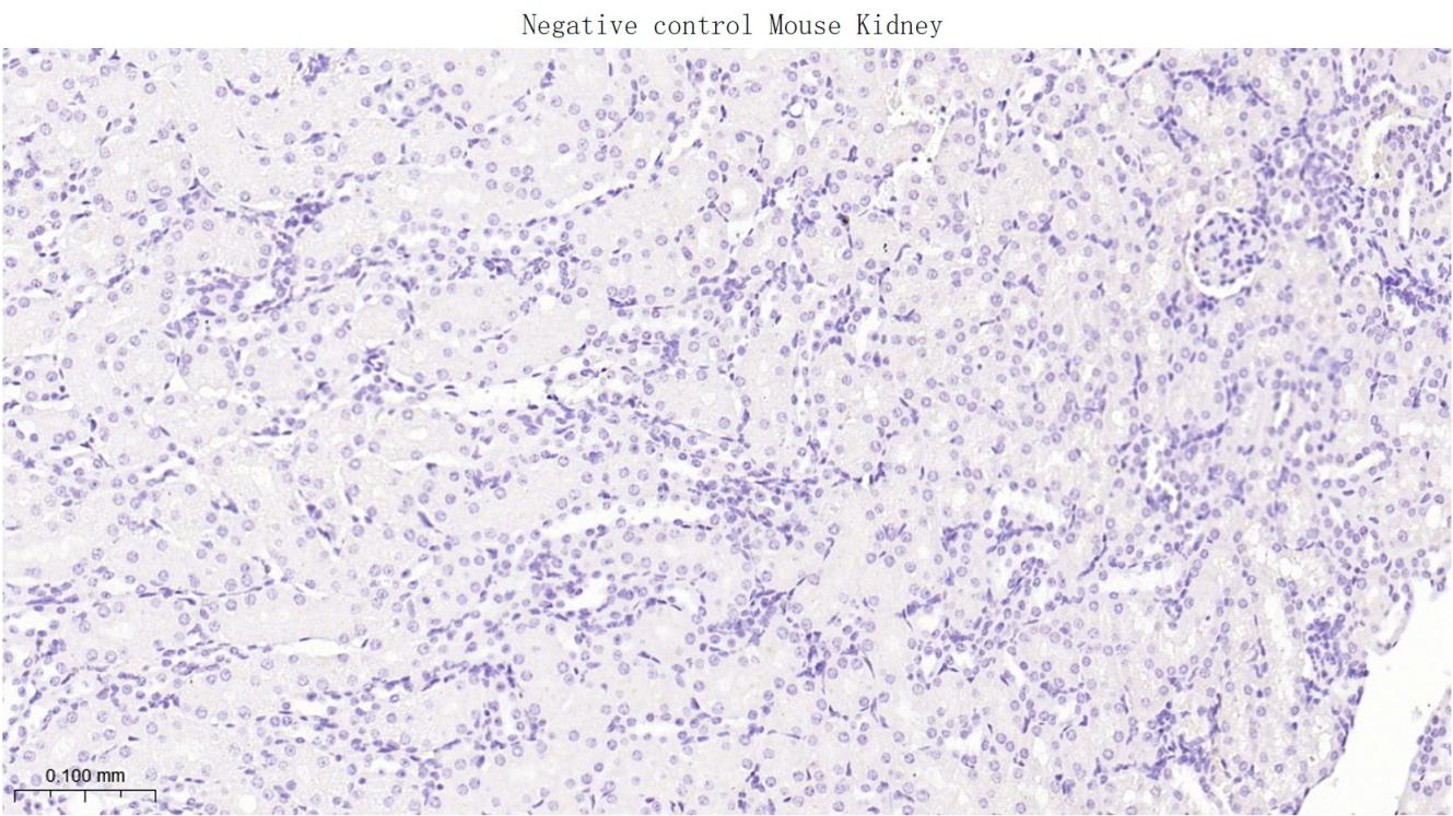 肝肠钙粘连蛋白重组兔单抗