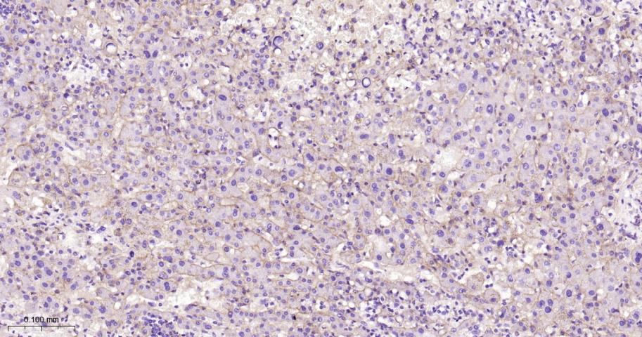 整合素β1（CD29）重组兔单抗