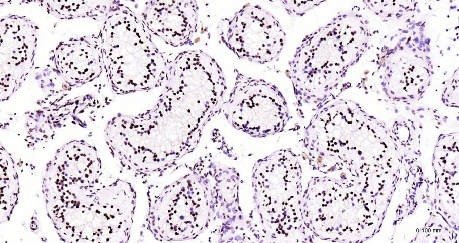 辣根过氧化物酶标记的山羊抗兔IgG（即用型二抗）-IHC005