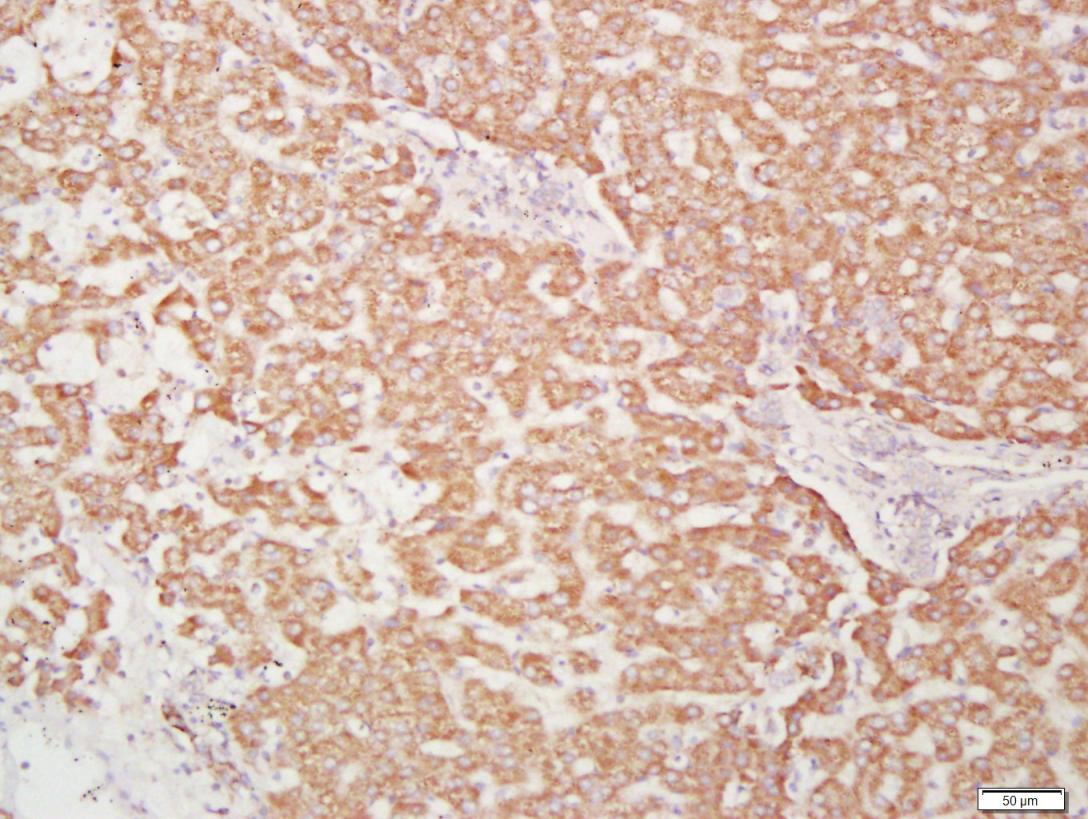 细胞表面趋化因子受体4抗体-bs-1011R