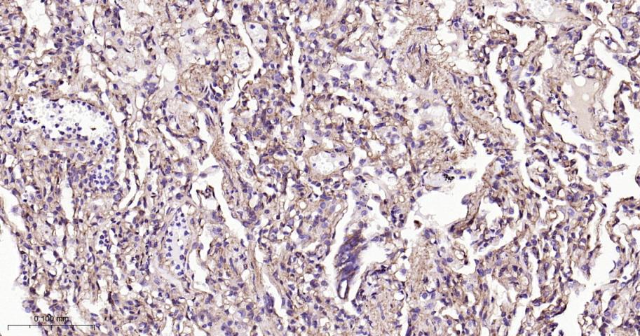 整合素β1（CD29）重组兔单抗