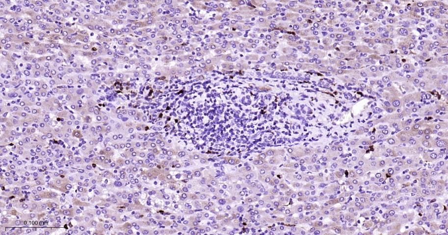 溶菌酶重组兔单抗