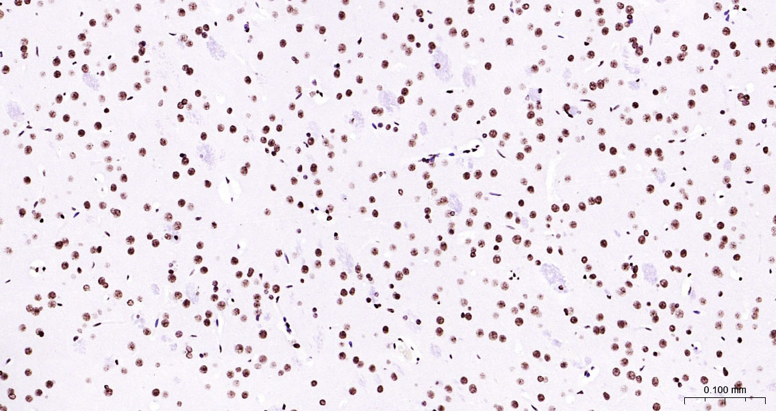 辣根过氧化物酶标记的山羊抗兔IgG（即用型二抗）-IHC005