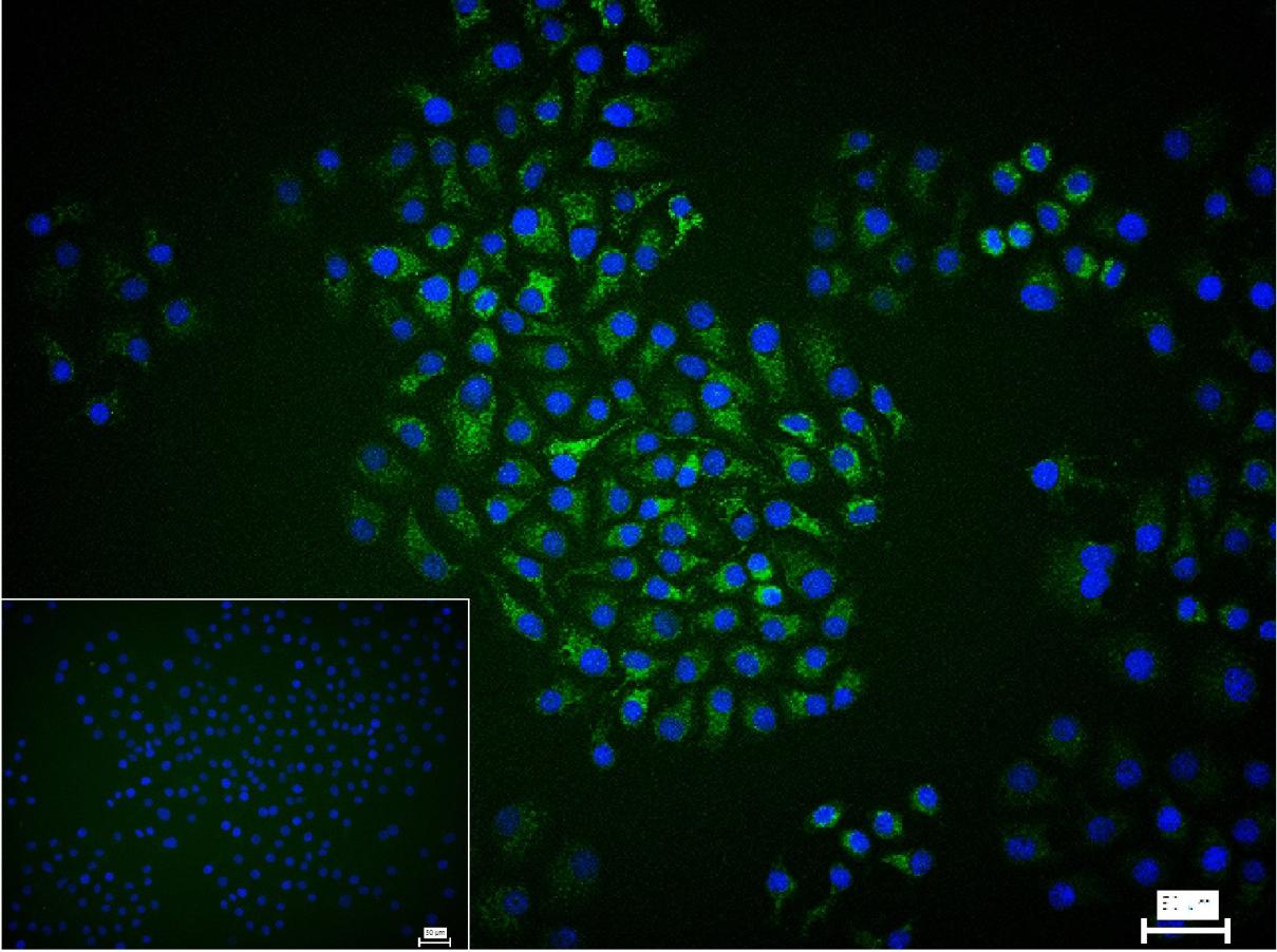 自噬相关蛋白4A重组兔单抗-bsm-61617R