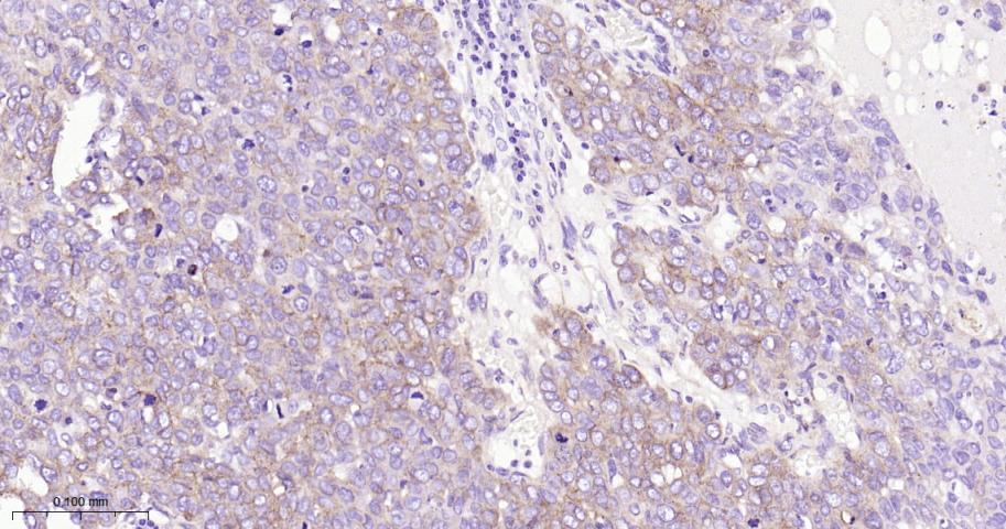 整合素β1（CD29）重组兔单抗