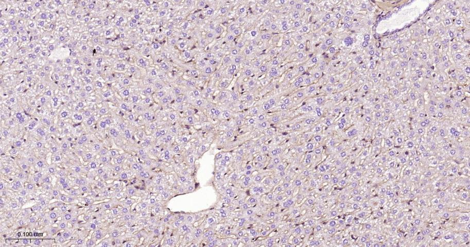 整合素β1（CD29）重组兔单抗