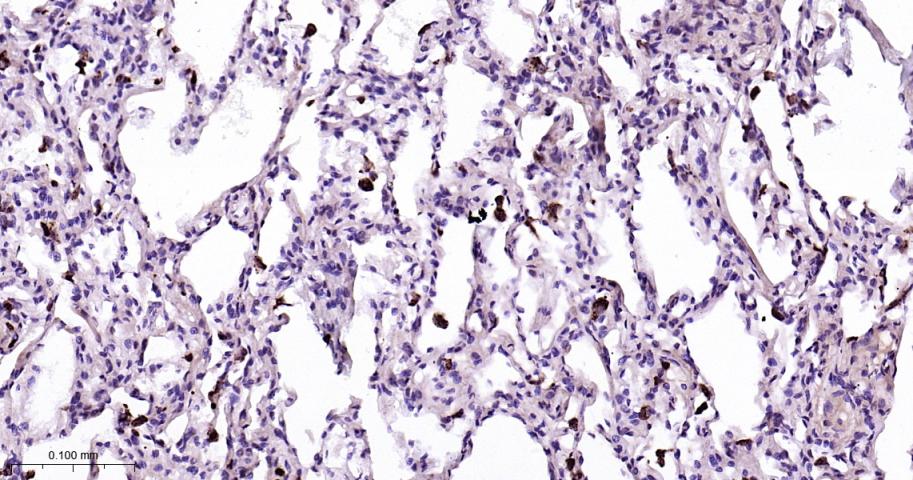 溶菌酶重组兔单抗