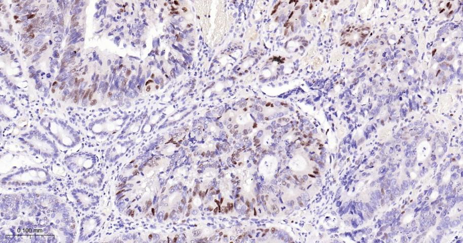p21蛋白重组兔单抗