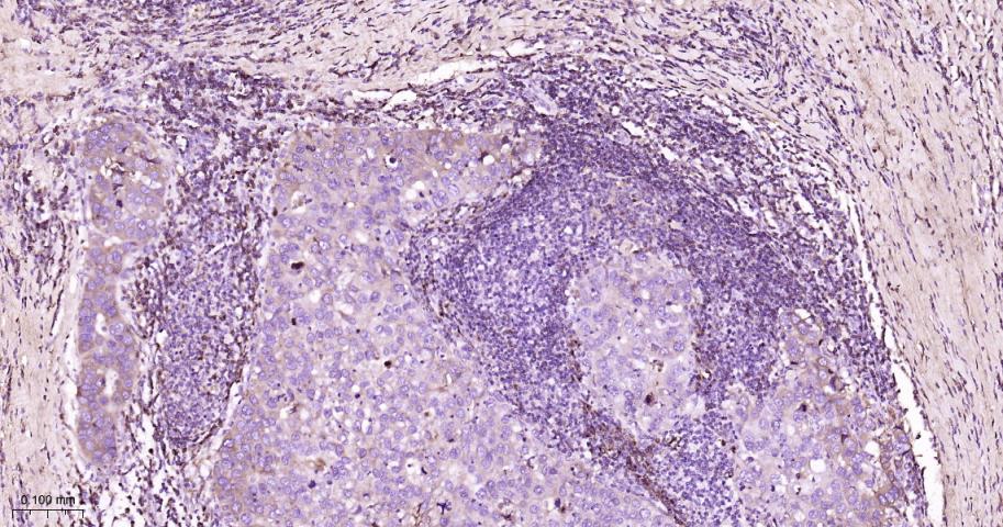 RAS癌基因相关蛋白RAB7重组兔单抗