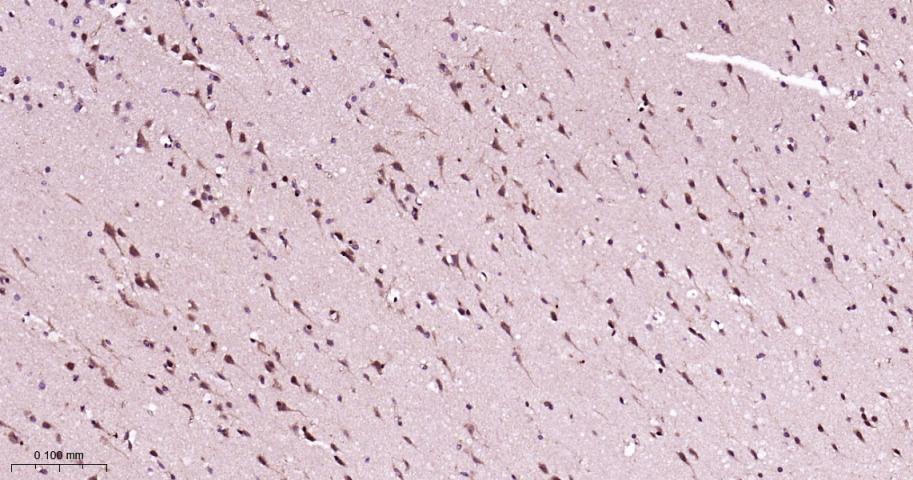 RAS癌基因相关蛋白RAB7重组兔单抗