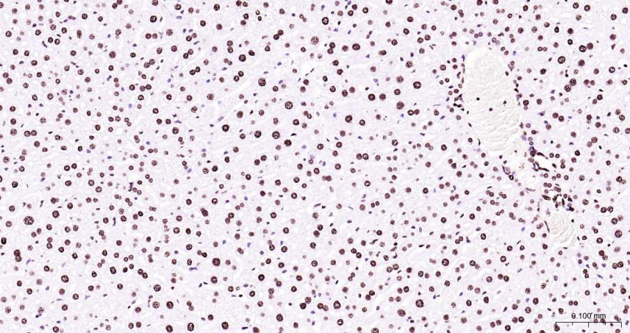 Goat Anti-Rabbit IgG H&L/HRP (Ready to use) (免疫学试剂) - IHC-P | Bioss