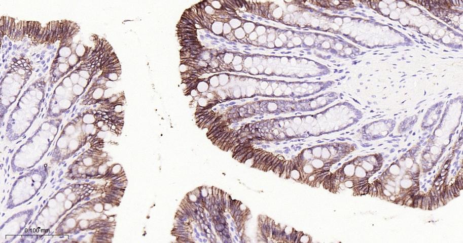肝肠钙粘连蛋白重组兔单抗