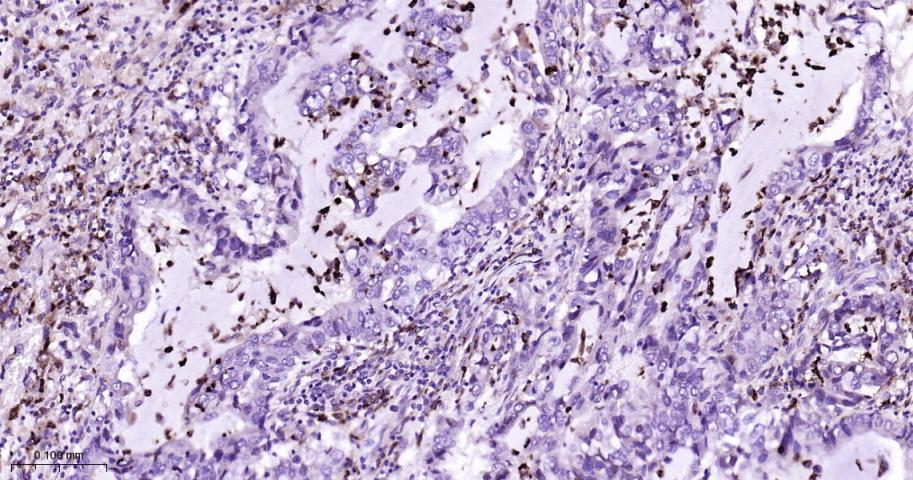 溶菌酶重组兔单抗