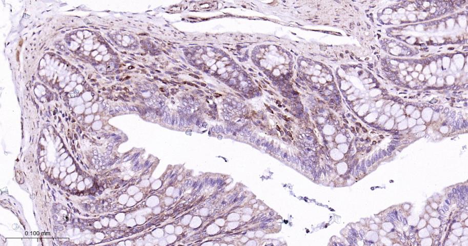 RAS癌基因相关蛋白RAB7重组兔单抗