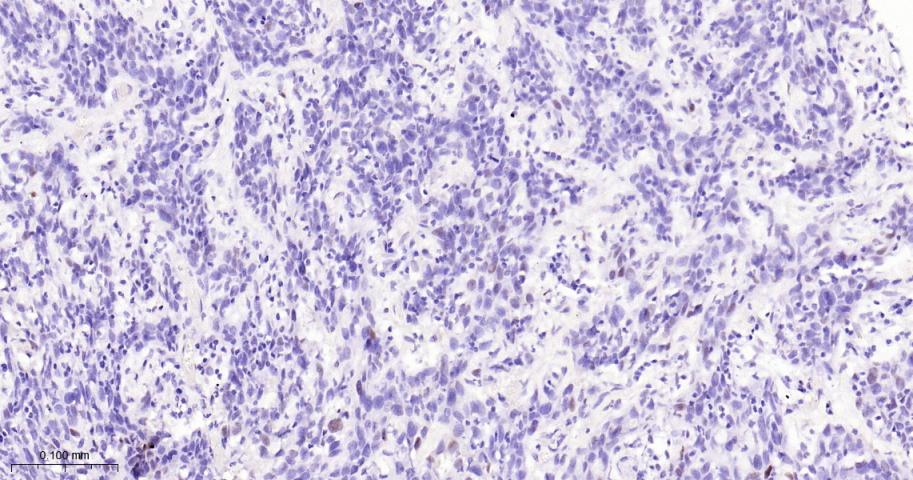 p21蛋白重组兔单抗