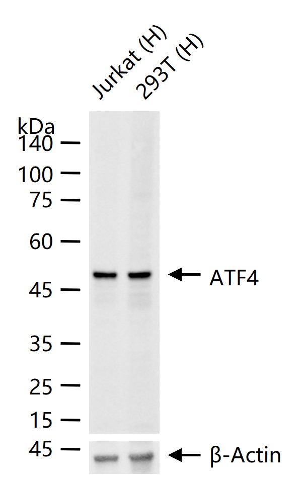 活化转录因子4重组兔单抗