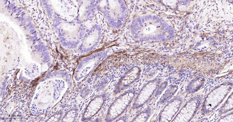 整合素β1（CD29）重组兔单抗