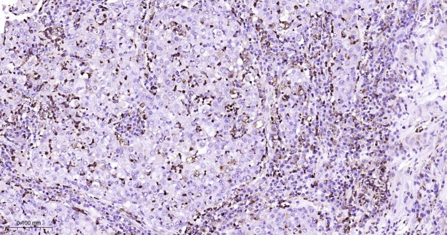 溶菌酶重组兔单抗