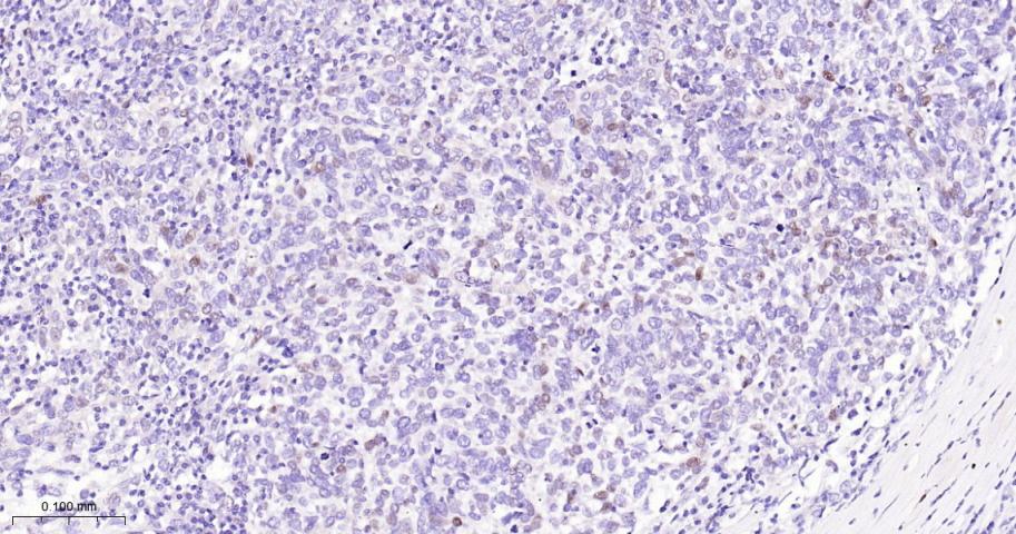 p21蛋白重组兔单抗