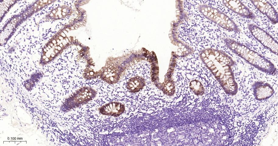 肝肠钙粘连蛋白重组兔单抗