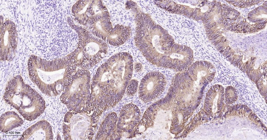 肝肠钙粘连蛋白重组兔单抗