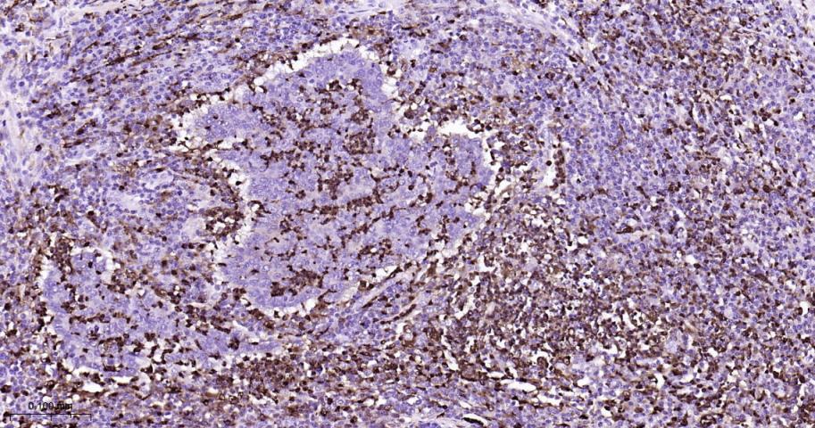 溶菌酶重组兔单抗