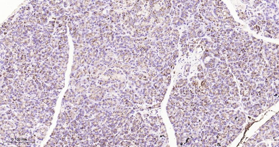 组织蛋白酶D重组兔单抗