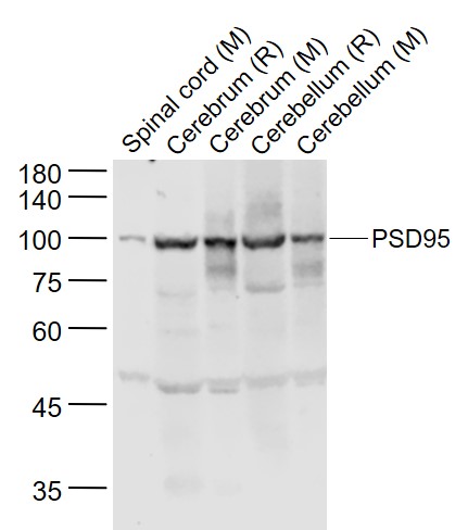 PSD95 Rabbit pAb (一抗) - WB | Bioss